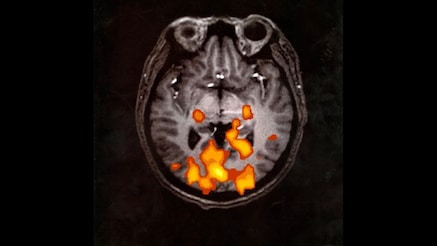 1990_Functional_MRI